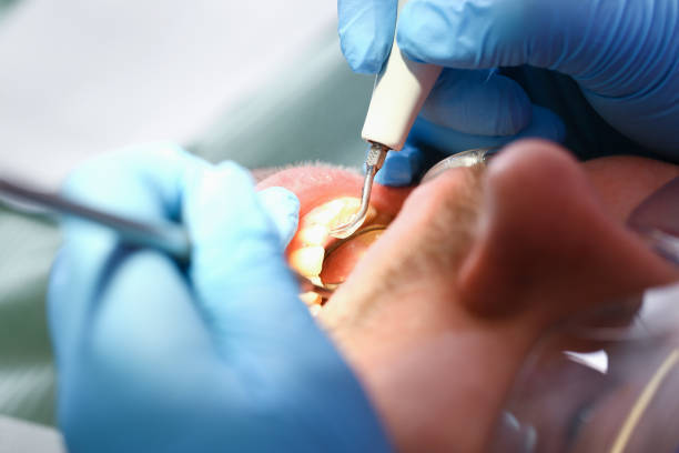 Best Orthodontic Emergency Dentist in Independence, VA